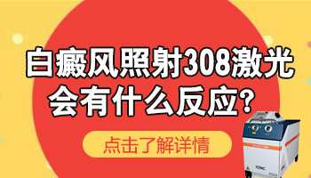 面部患有白癜风要如何治疗护理呢?